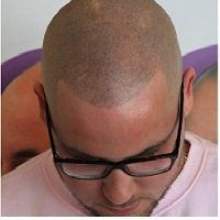 man with shaved head look