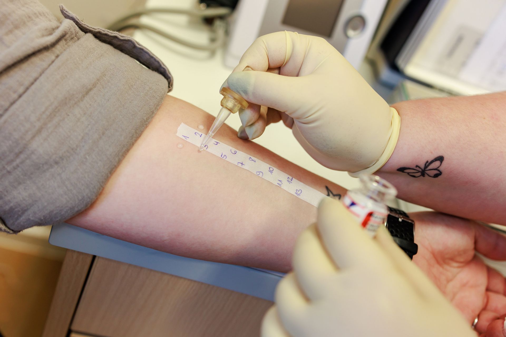 Was ist eine Allergie und wie entstehen Allergien?