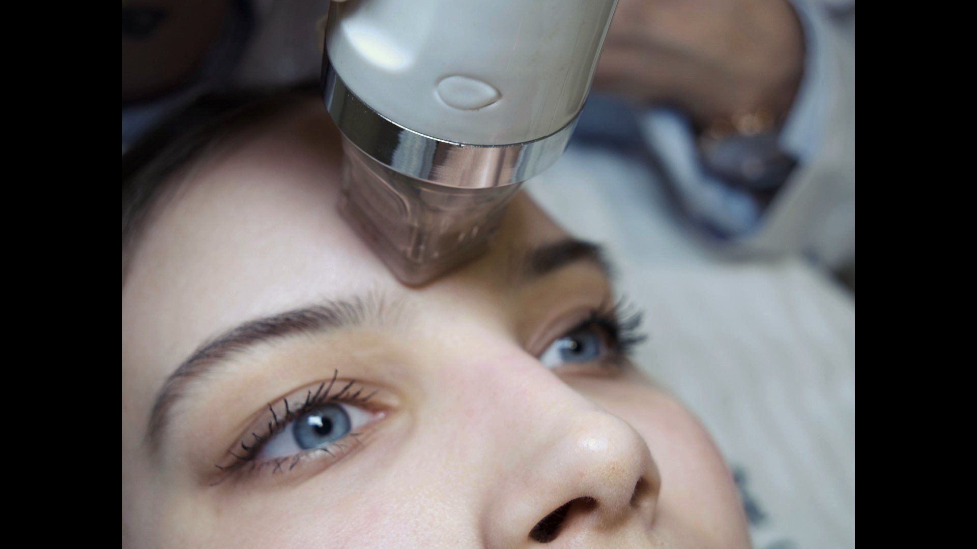 Foto einer Kundin, die eine Microneedling Behandlung durchführen lässt bei Ana Wimmer