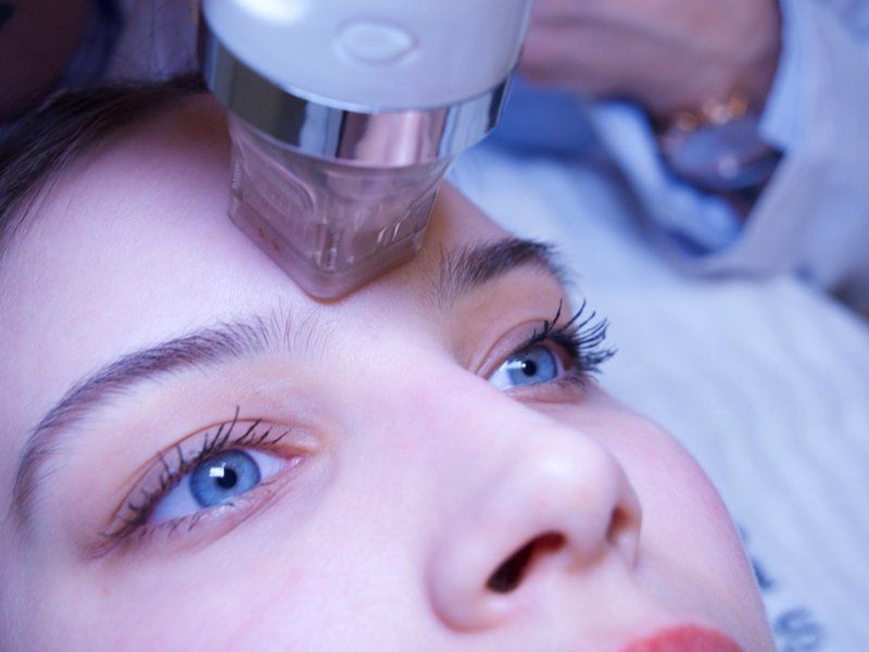 Foto einer Kundin, die eine Microneedling Behandlung durchführen lässt bei Ana Wimmer