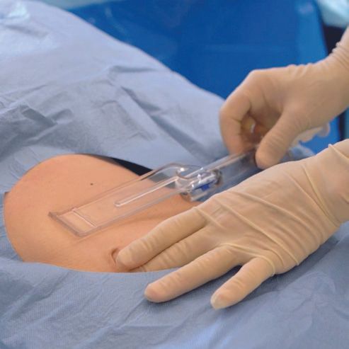 Einfache, schnelle und sichere Eigenfettentnahme mit SEFFILLER Einfache, schnelle und sichere Eigenfettentnahme mit der innovativen Führungsschiene von SEFFILLER.