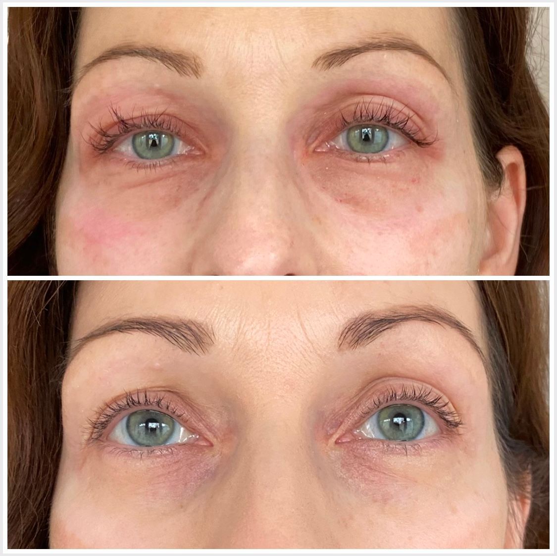 Permanent Concealer vorher nachher Augenringe Tattoo Schulung Berlin Frankfurt Hamburg Dresden
