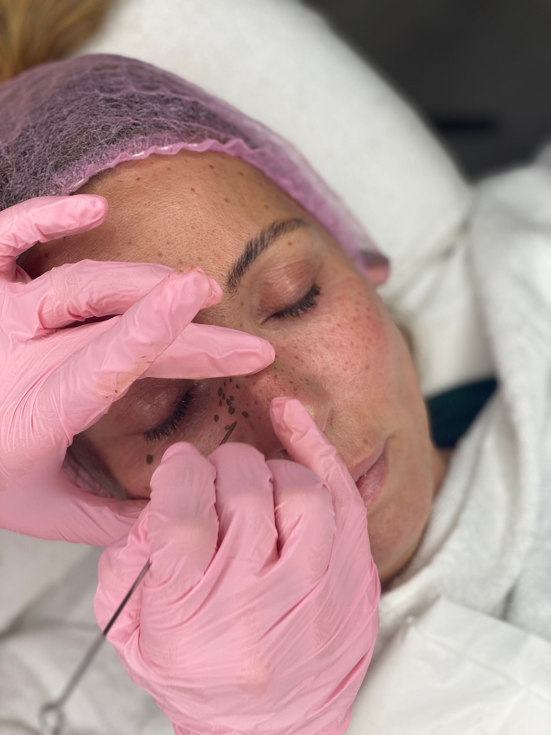 Sommersprossen Fake Freckles pigmentieren Tattoo Berlin Brandenburg