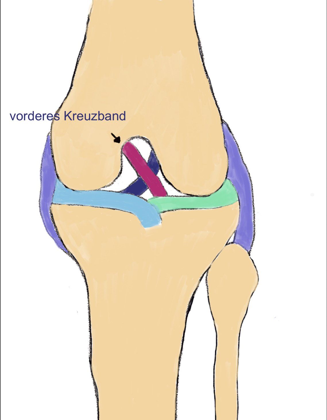 In der Regel ist das vordere Kreuzband betroffen Der Kreuzbandriss beim Hund