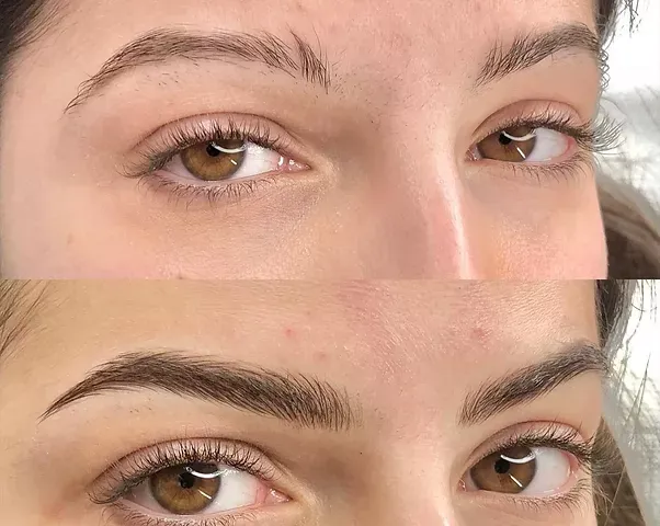 Membrana capillare future hair beicapelli.it