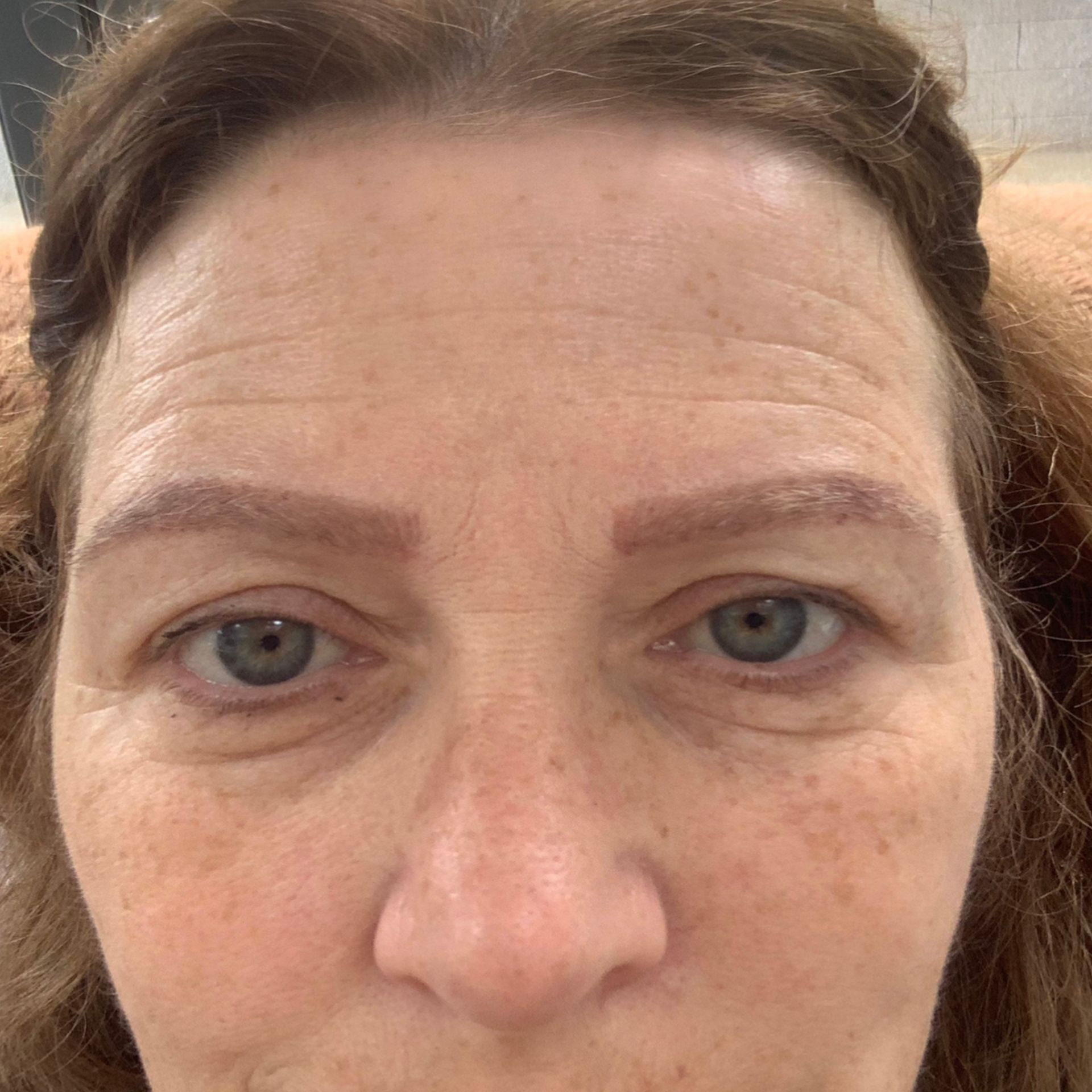 Blue microblading removal done at Dana Depta Permanent Makeup