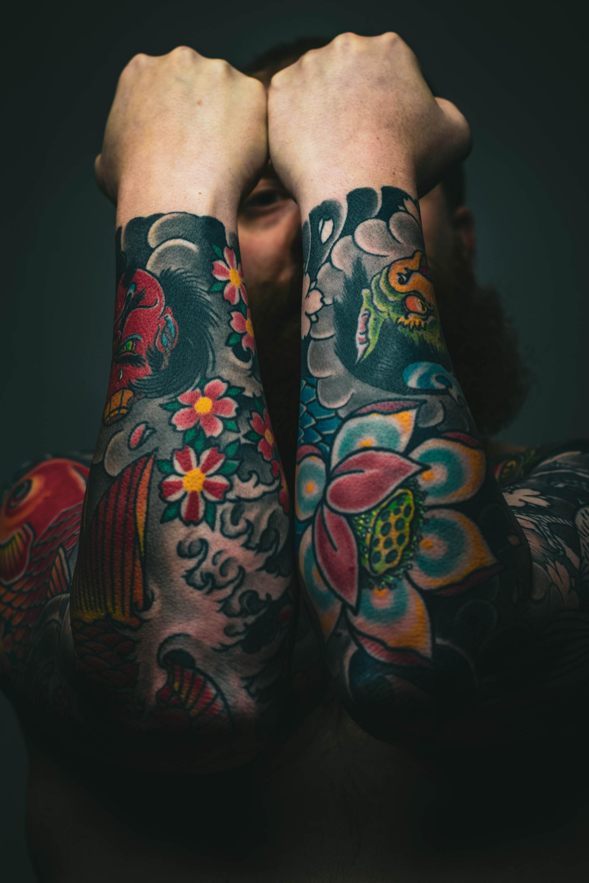 Tattoo removal London