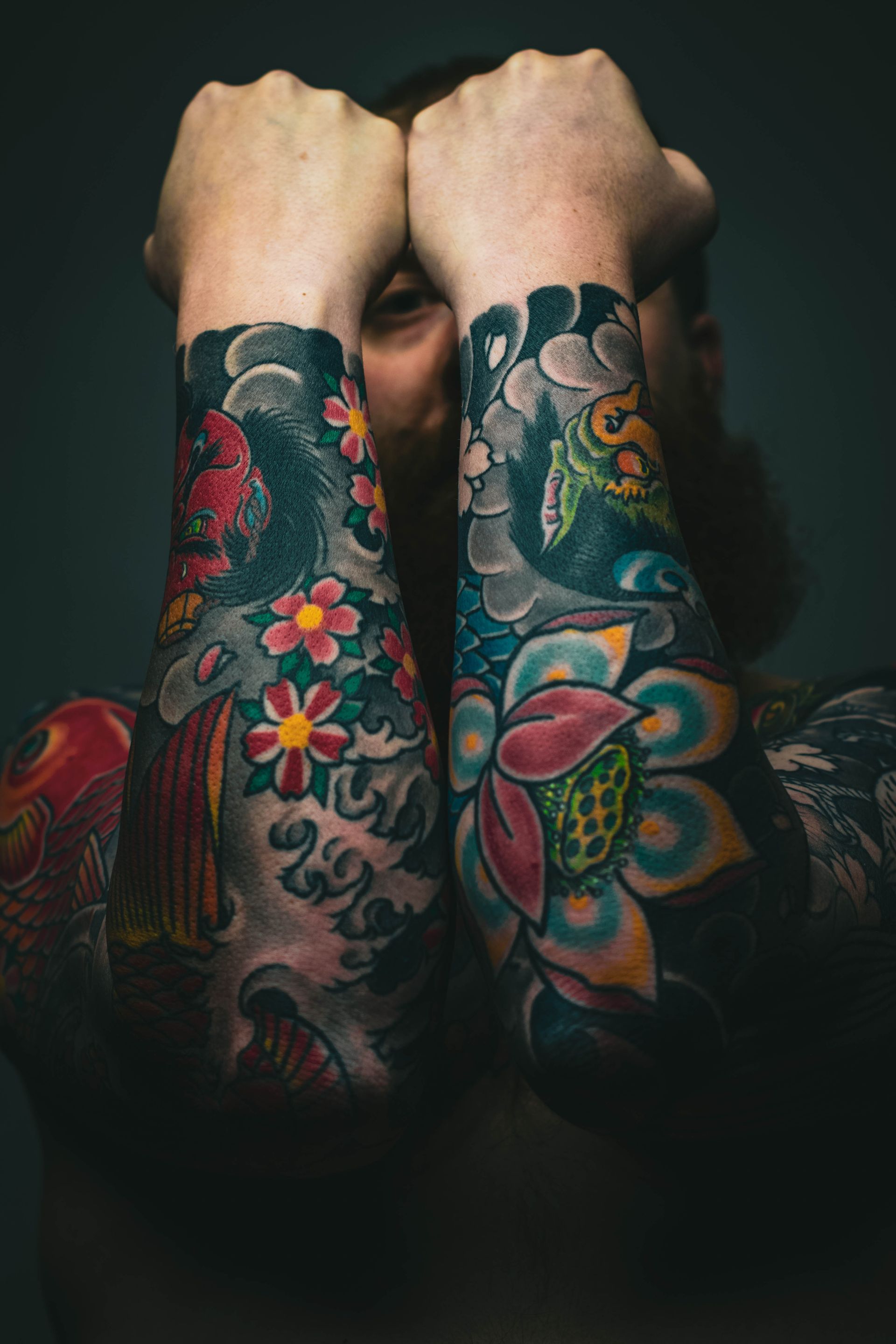Tattoo removal London