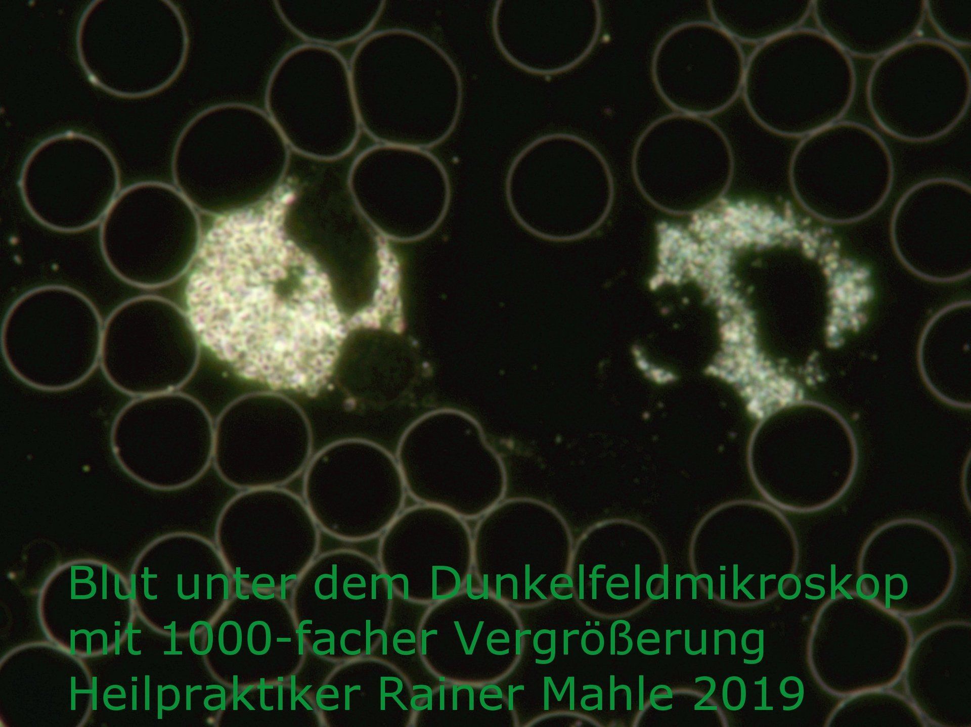 blut unter dem dunkelmikroskop