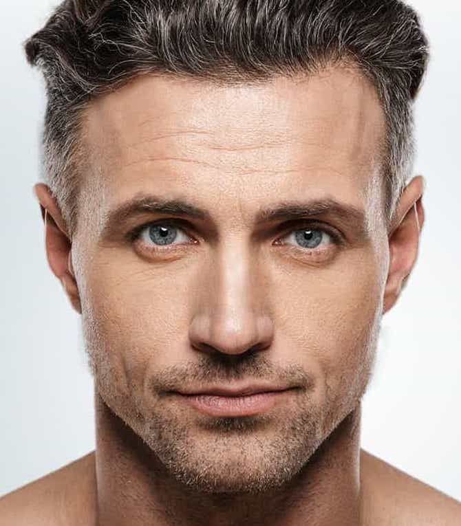 Lipofilling Dr Eric BONAFOS  Lipofilling Dr Eric BONAFOS Montpellier